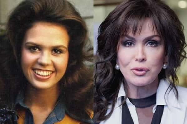 Marie Osmond Without Makeup - Celebrity In Styles