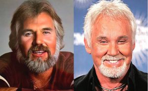 Do You Like Kenny Rogers Plastic Surgery? (Before and After Photos)