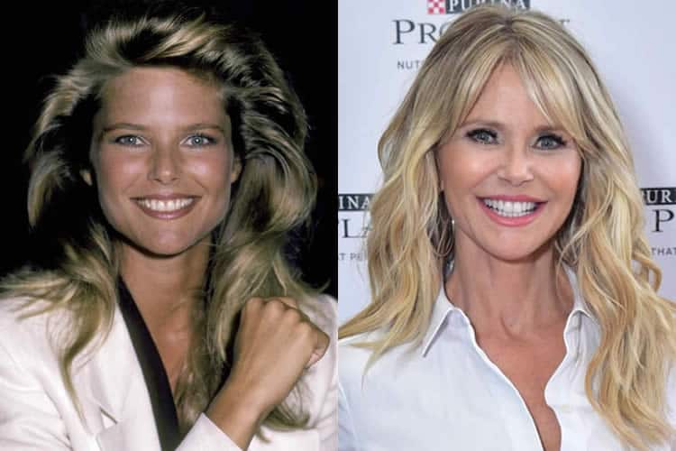 free did christie brinkley have plastic surgery