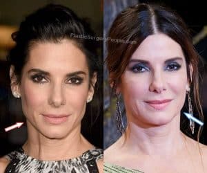 Did Sandra Bullock Have Plastic Surgery? (Before & After 2021)