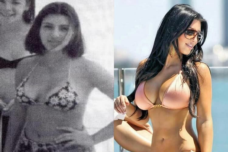 Kim Kardashian Plastic Surgery REVEALED! (Before & After Pics )