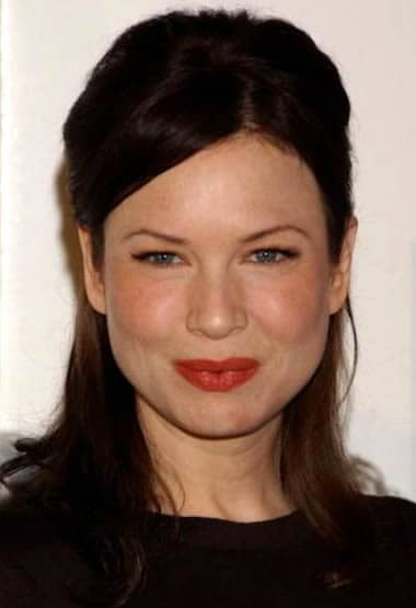 Renee Zellweger Plastic Surgery REVEALED? (Before & After 