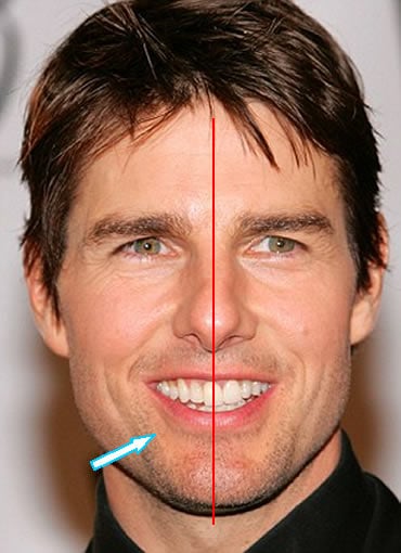 tom cruise front tooth in the middle of his face