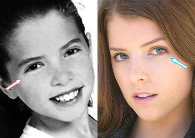 Hat Anna Kendrick Arbeit an ihren Augen?