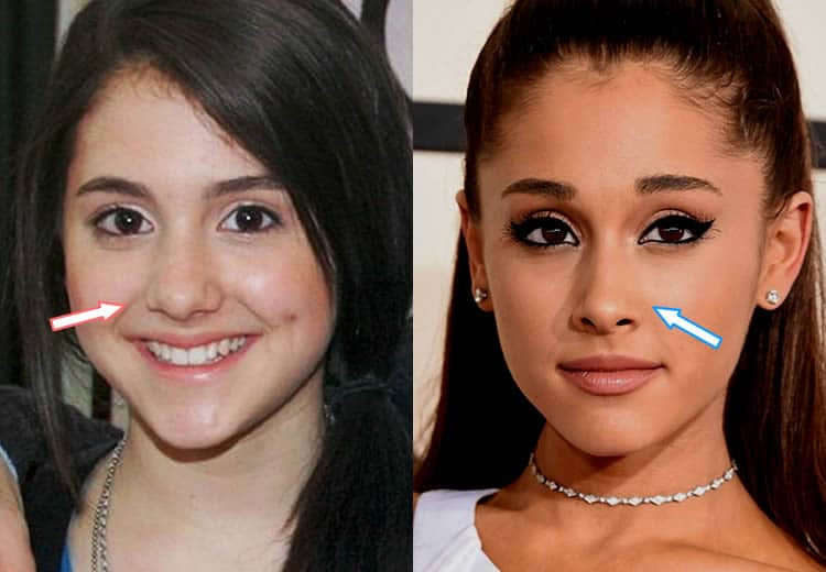 Ariana Grande Antes Y Despues