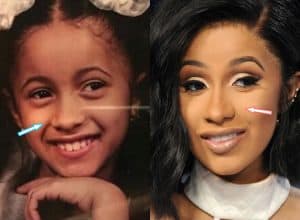 Cardi B Plastic Surgery REVEALED! (Before & After Photos 2021)