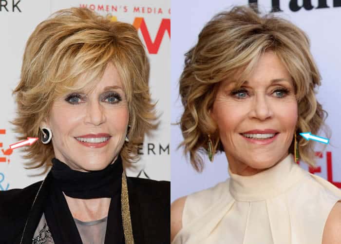 Jane Fonda Plastic Surgery Dissimilar To Numerous Other Hollywood Stars