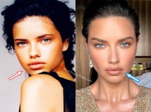 Did Adriana Lima Have Plastic Surgery? (before & After 2020)