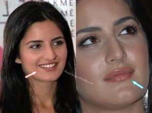 Did Katrina Kaif Have Surgery To Look HOT?