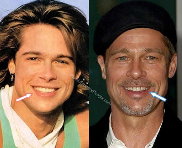 Brad Pitt Teeth Fight Club