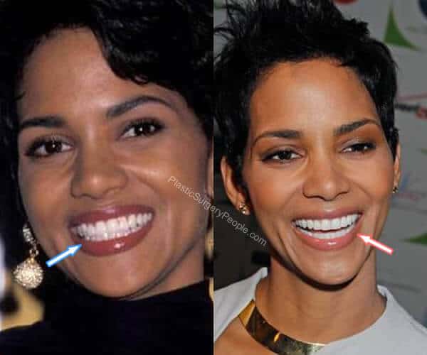 Halle Berry Before And After 21