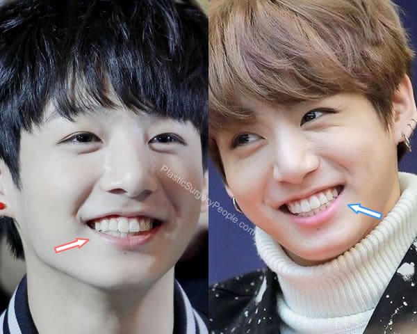 Jungkook: BEFORE and AFTER 2022