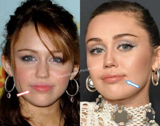 Miley Cyrus, BEFORE and AFTER 2022