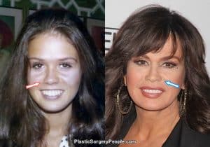 Marie Osmond: Before And After 2020