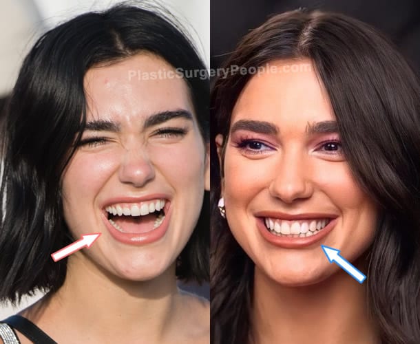 Dua Lipa BEFORE and AFTER 2022